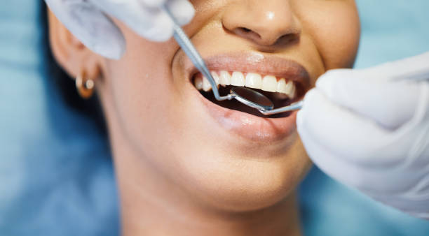 Best Emergency Dentist for Knocked-Out Tooth in Covington, WA