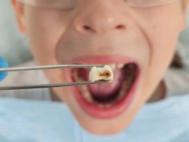 Best Emergency Dental Services for Seniors in Covington, WA